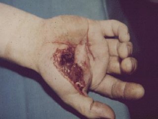 LESION (24)  IMAGENES FOTOS